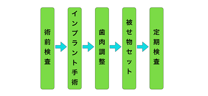 インプラント